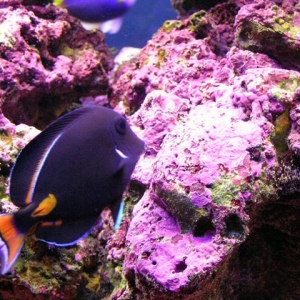 achilles tang