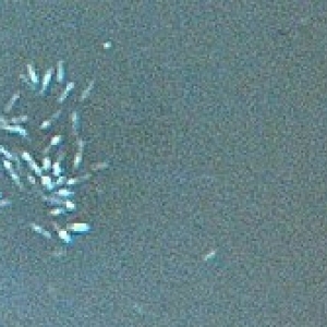 Skimmate Bacteria