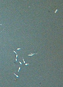 Skimmater Bacteria
